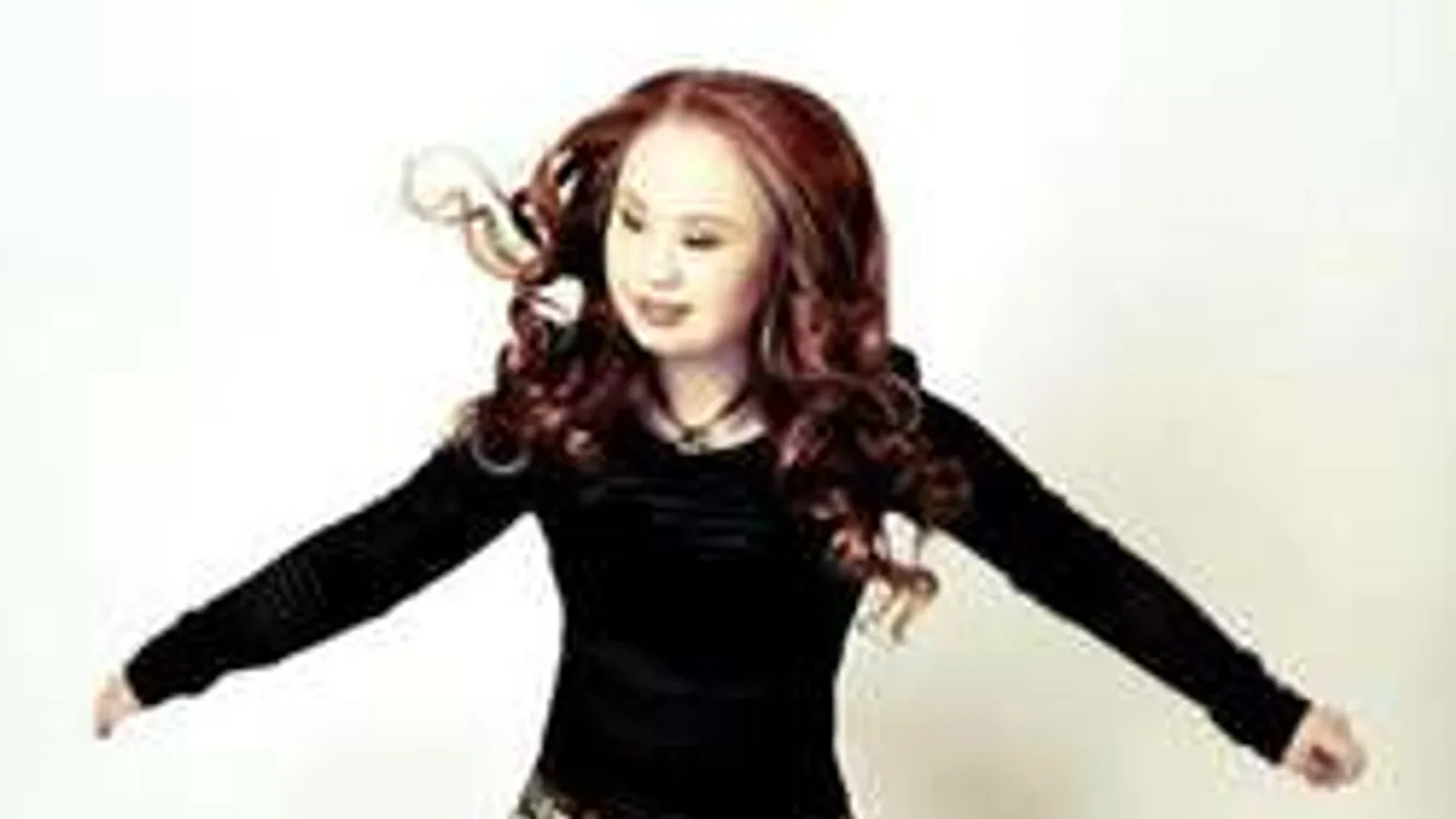 Divatmodell lett a Down-szindrómás kislány! Õt már nem sterilizálták...