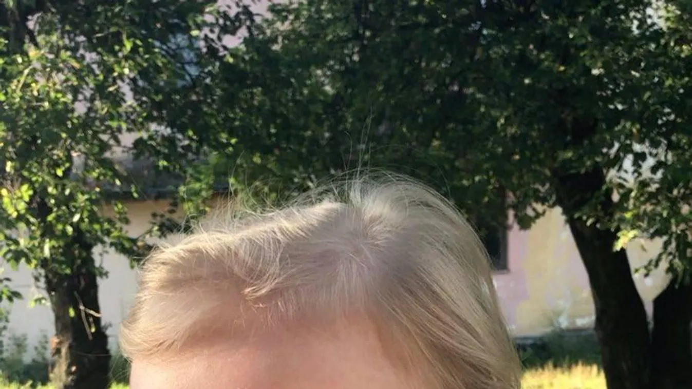 Ritka betegségben szenved a kétéves Annácska, segítségre van szüksége