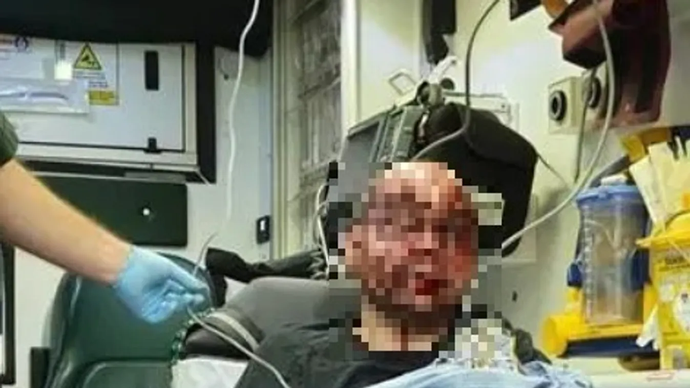 Sokkoló fotó: folyt az arcáról a vér, a felismerhetetlenre verték a munkába igyekvő férfit