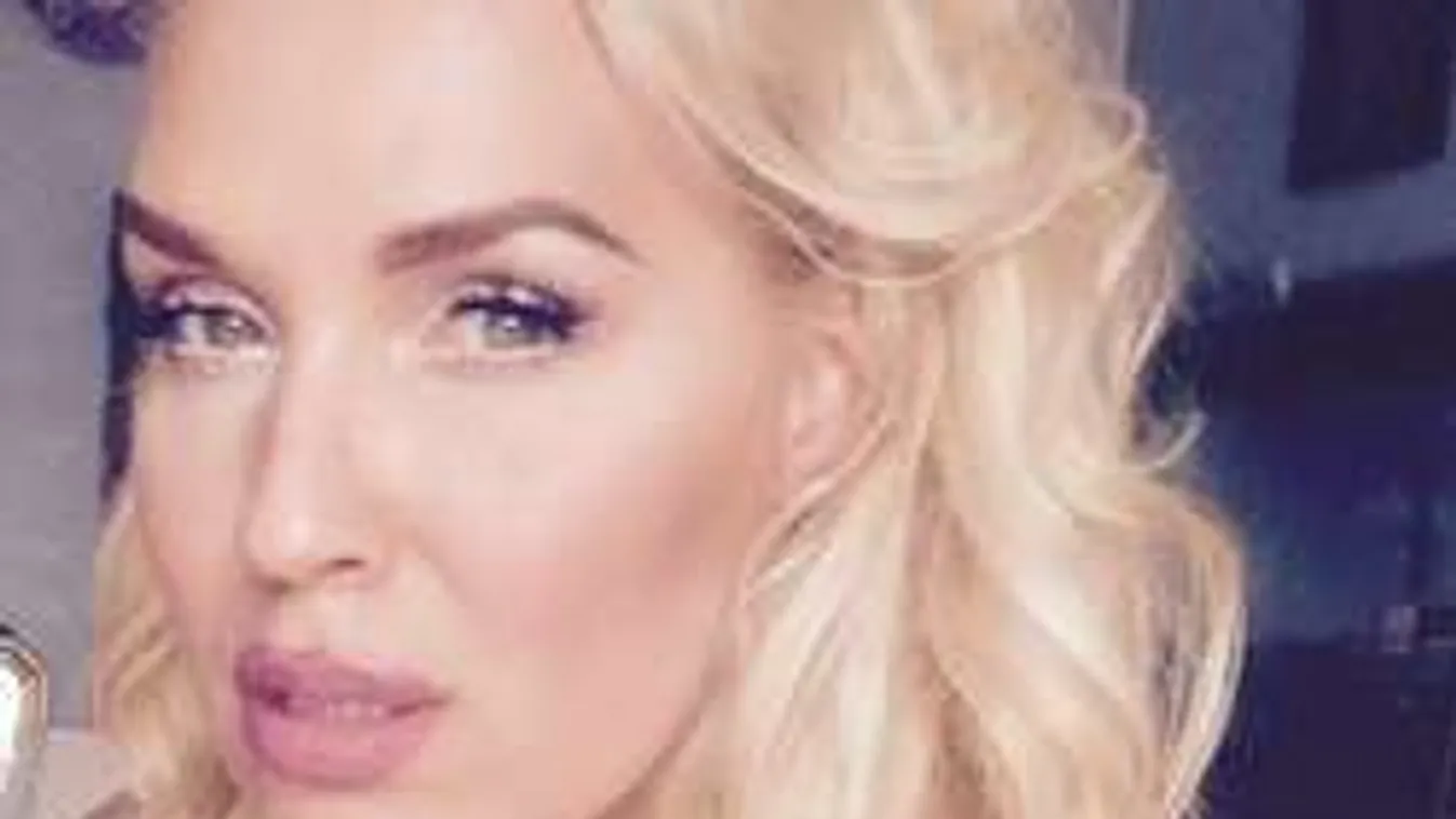 Kiderült: Titokban plasztikáztatott a magyar színésznő!