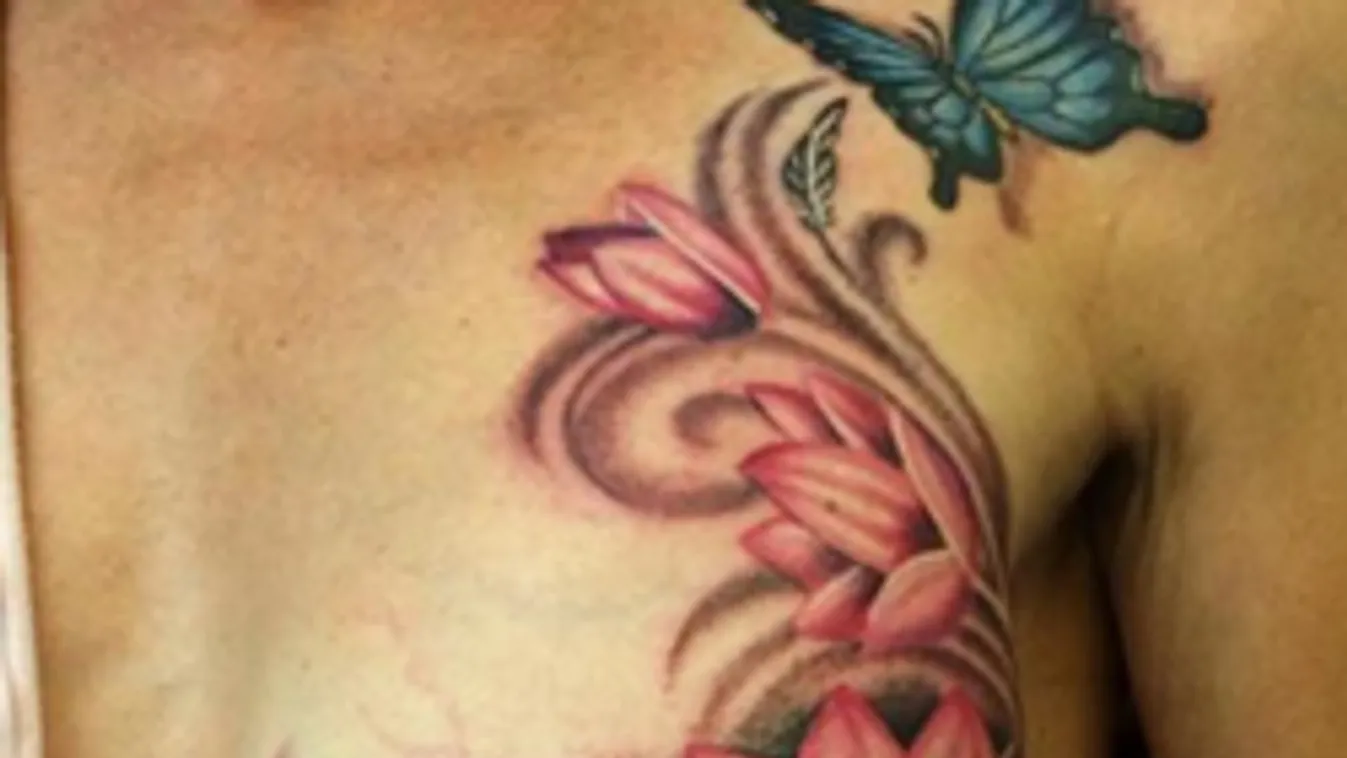 Rákos betegeken segít a tetoválás