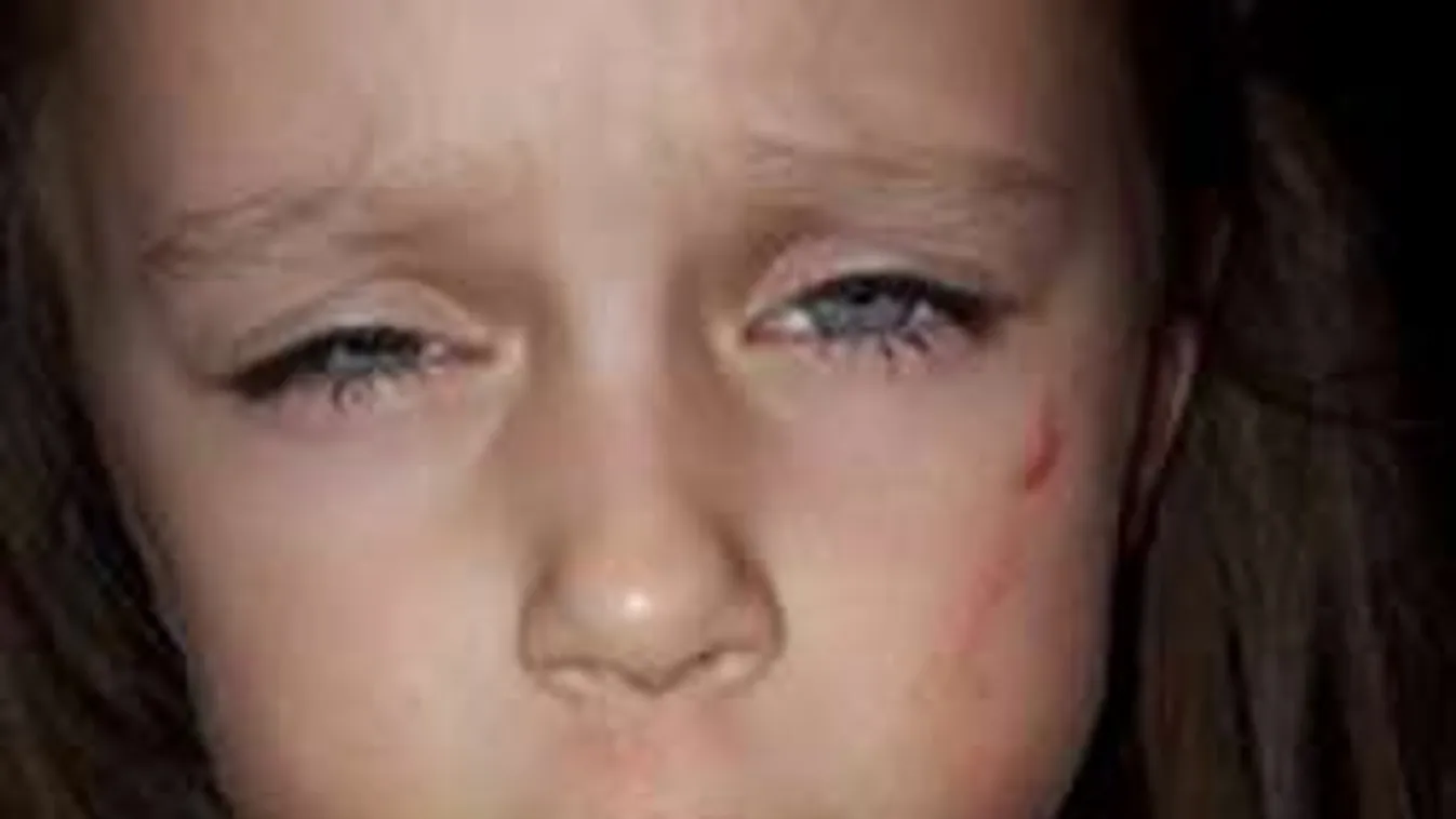 Megrázó brutalitás a magyar óvodában: ököllel ütötték a kislányt