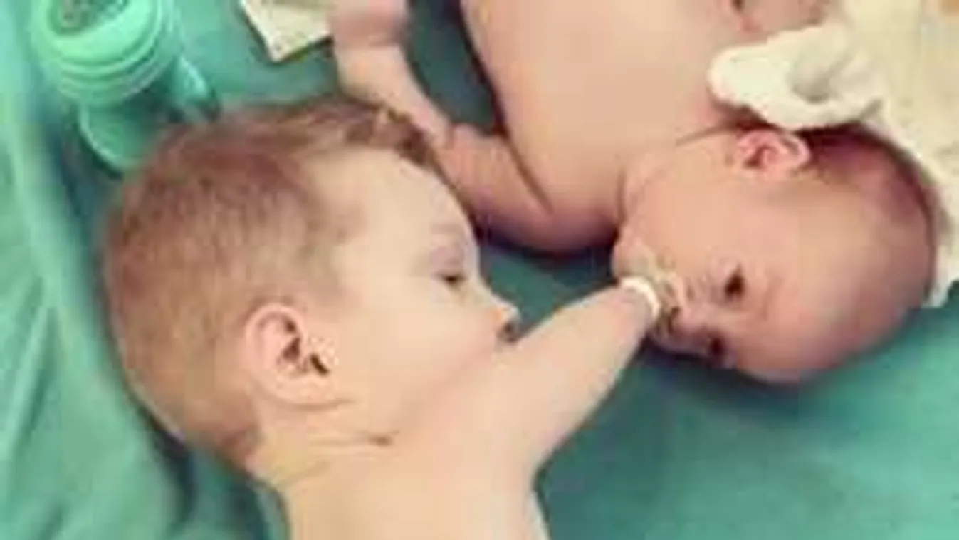 Szívfacsaró felvétel: kar nélküli kisfiú ölelné síró kistestvérét