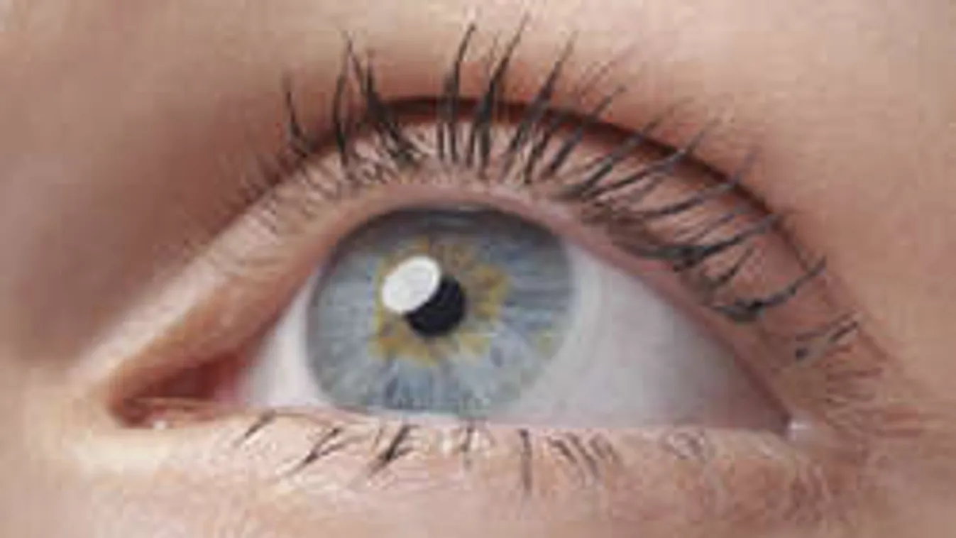 Kivágták a szemét, mert elfertőződött a kontaktlencséje