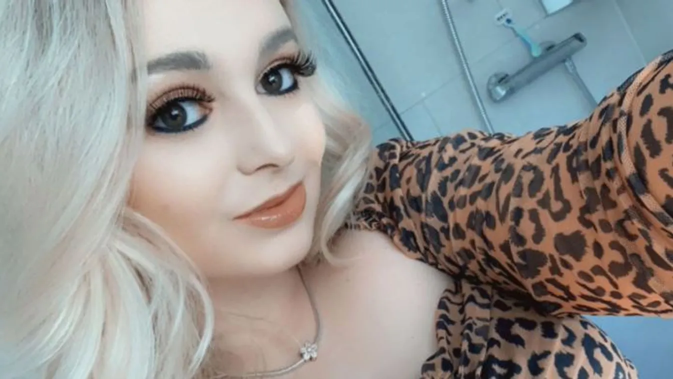 Rutin szemvizsgálatra ment a fiatal lány: sokkot kapott attól, amit az orvos talált