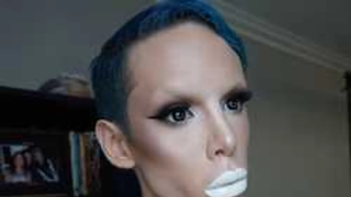 UFO-vá akar válni a 22 éves férfi, már 110 operáción van túl