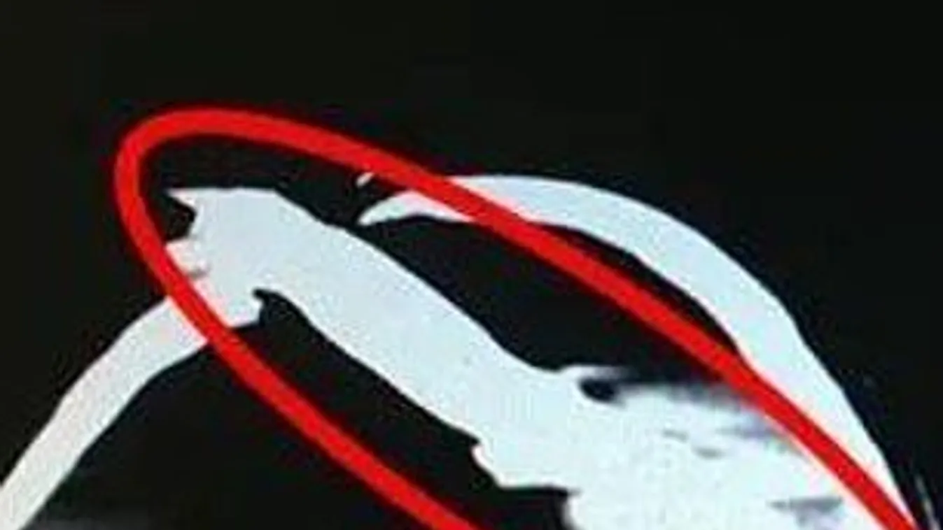 Sokkot kapott az orvos, amikor meglátta a férfi koponya CT-jét