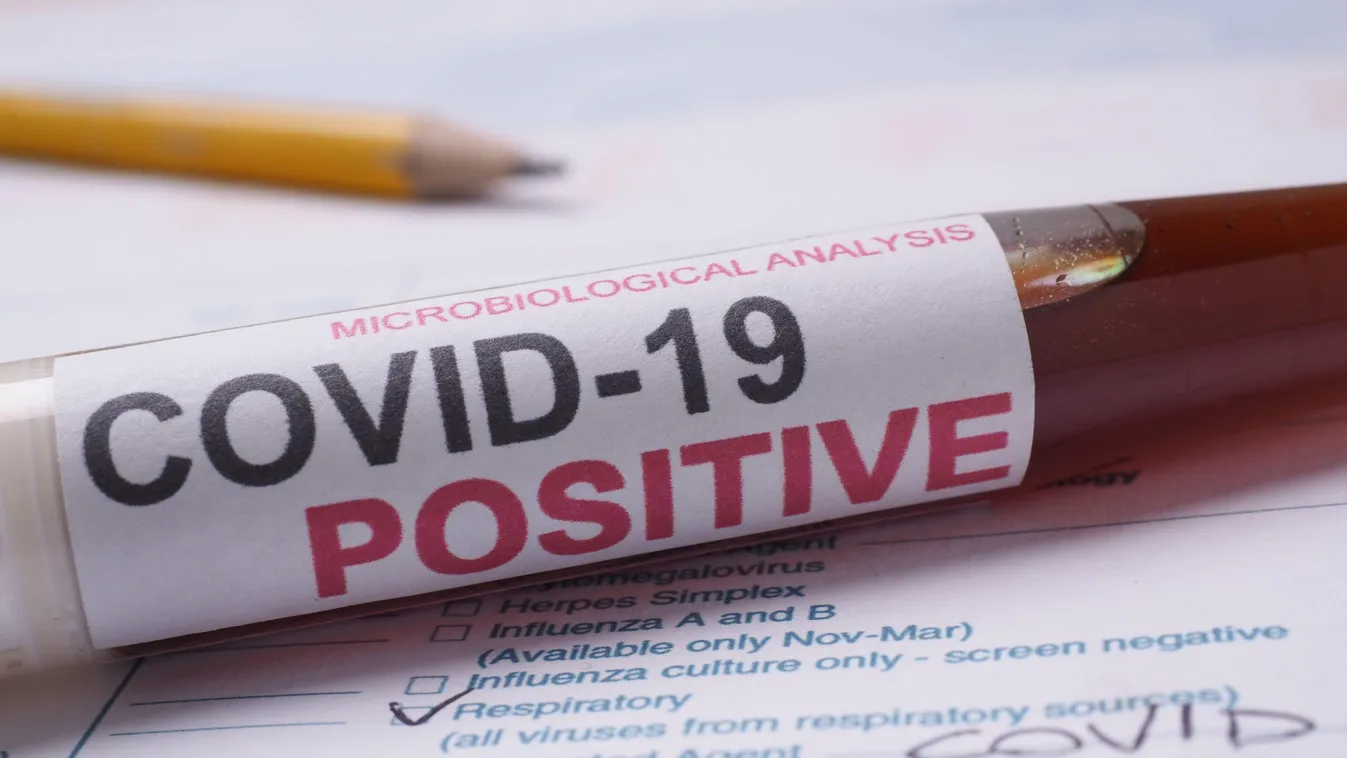 Covid-19 coronavirus lab test with label on test tube