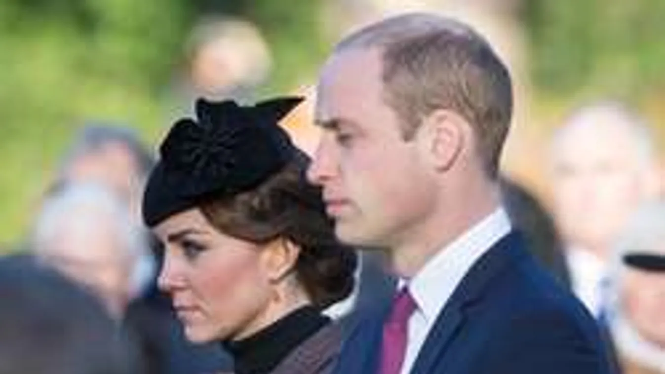 Vilmos herceg kopaszsága elképesztő méreteket öltött