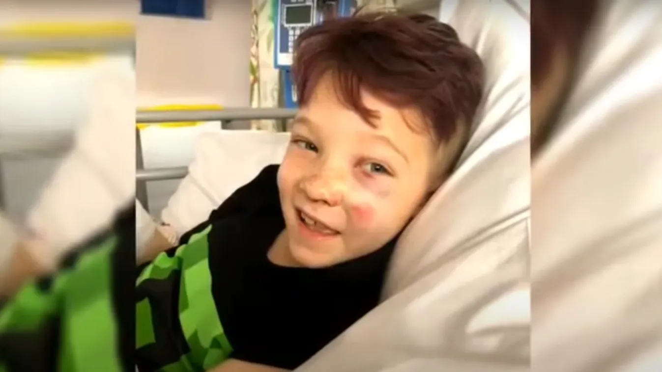 Egy pillanat műve volt: egy ész nélkül száguldó motoros zúzta szét a 9 éves kisfiú álmait