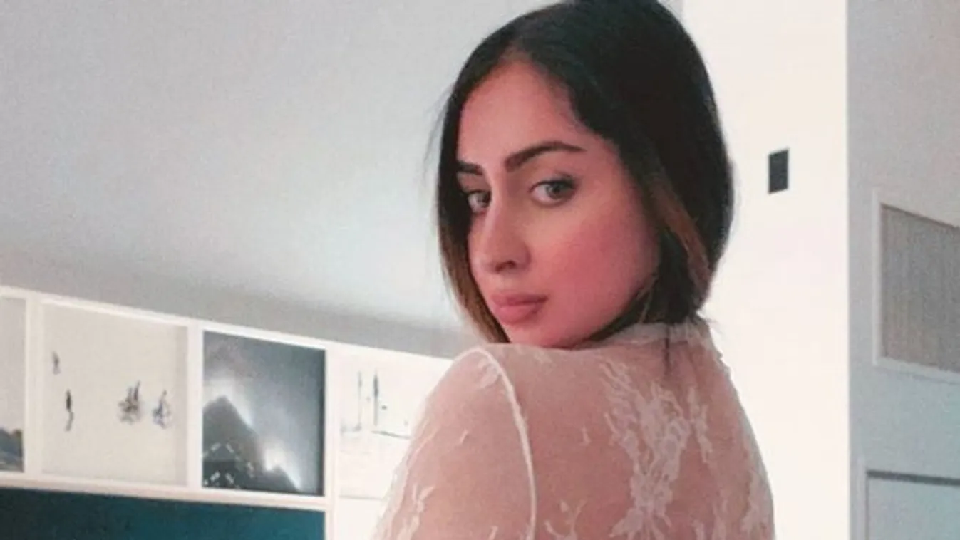 Borzalmasan sikerült a dögös modell fenékplasztikája, le se tudott ülni