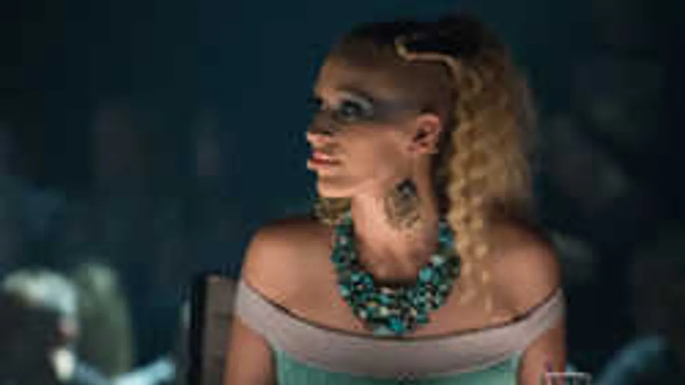 Ijesztő fotó, felismerhetetlen lett a magyar sztárénekesnő arca