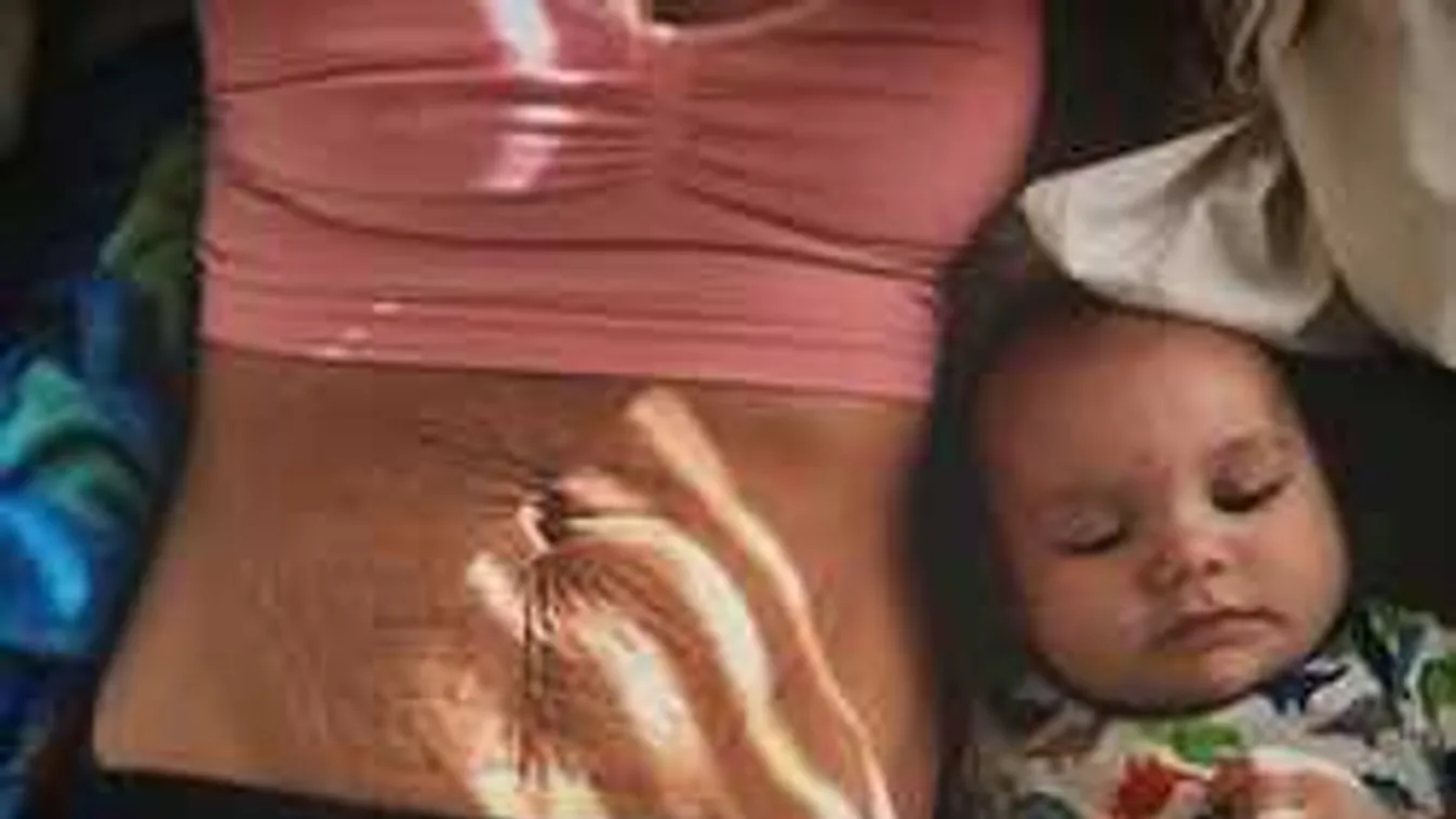 Ez a bátor nő megmutatta a terhesség legsötétebb oldalát