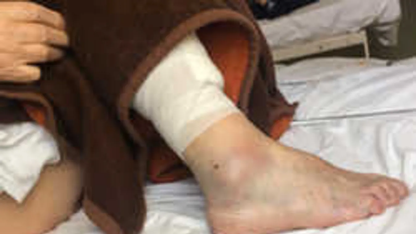 A Ripostnak megszólalt a panelból kiesett férfi: 15 percen keresztül lógtam fejjel lefelé