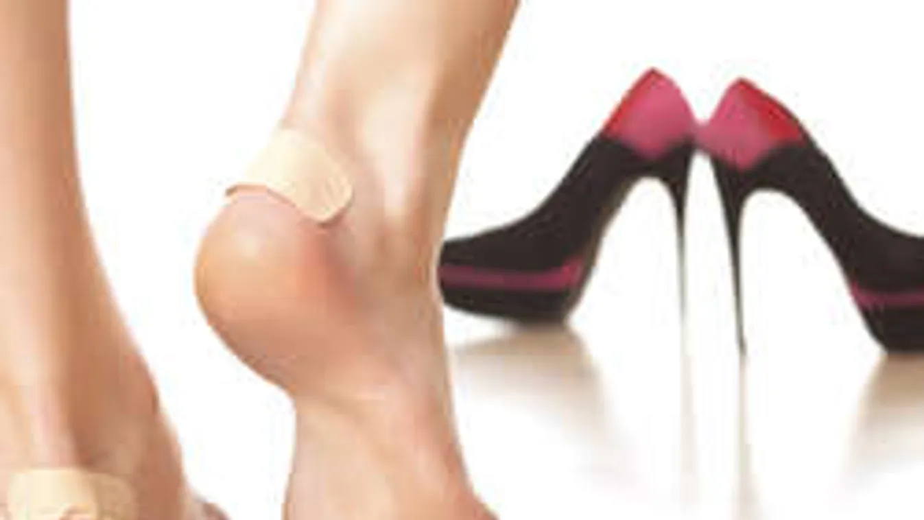 A nyár fájdalmas nyavalyája. Így gyógyítsd gyorsan a vízhólyagot!