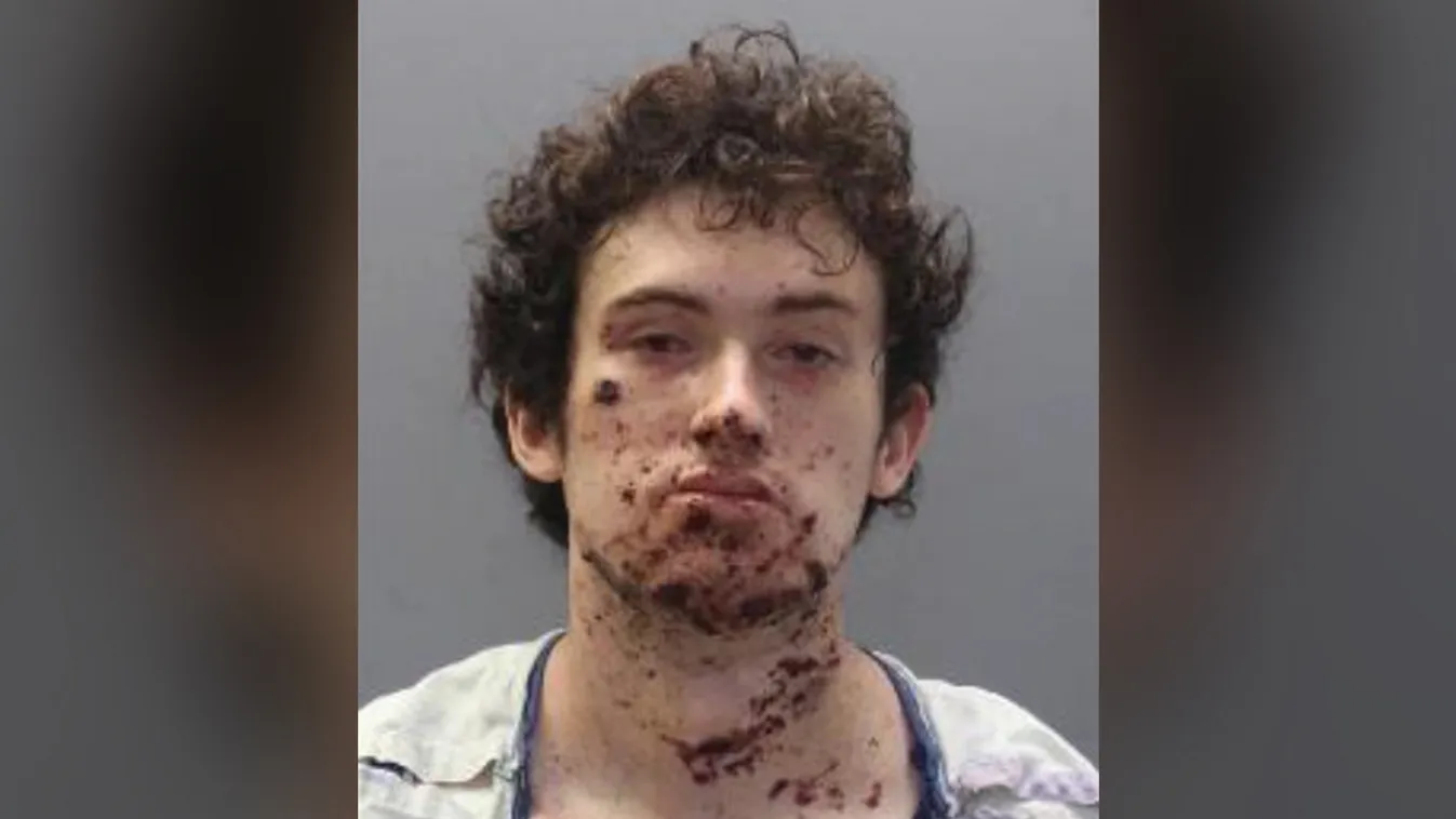 Gyilkolni akart, de a saját kezét robbantotta le