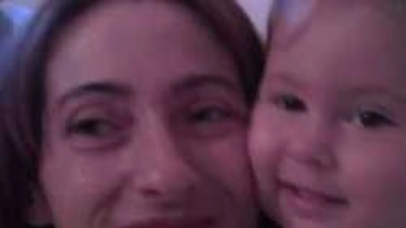 Elképesztő, mekkora bajt okozott egy hajszál a kislánynak