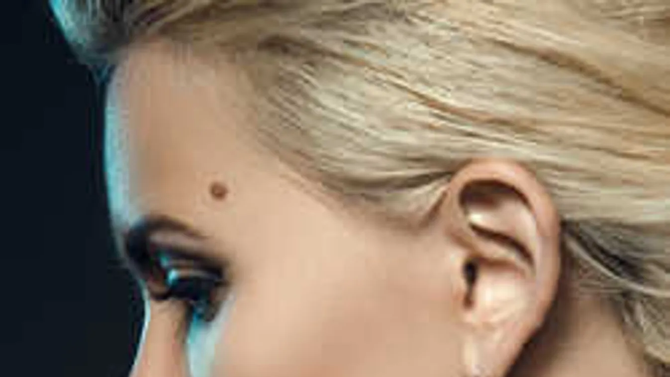 Titokzatos jelek a testeden: Kiderült, mit üzennek a szépségpontok