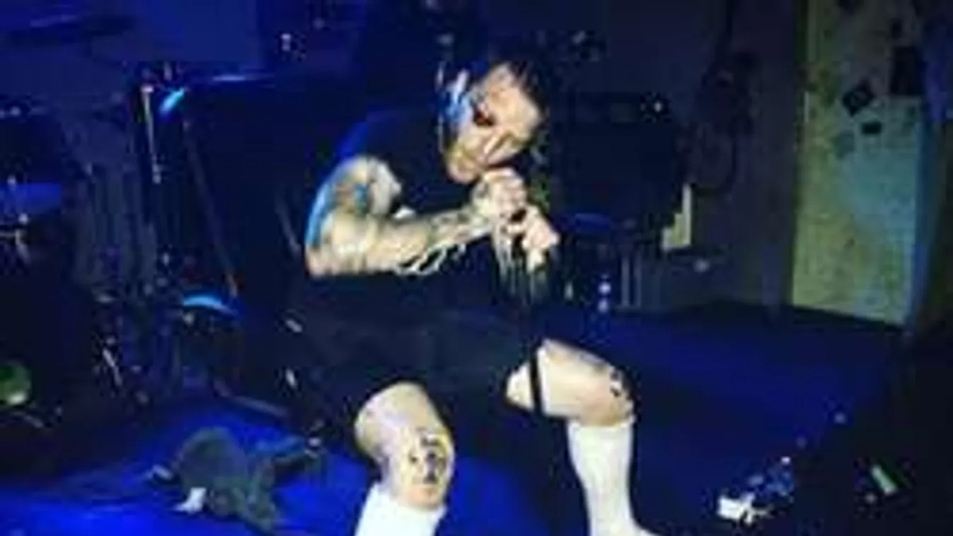 Szörnyű baleset: A színpadon roncsolódtak szét a népszerű énekes lábai!