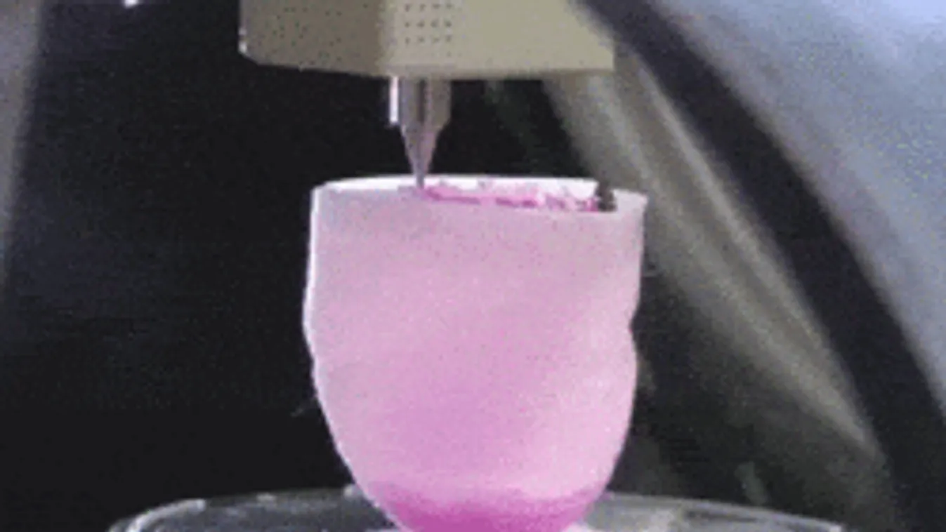 Jön a nyomtatott vese! Vége a várólistának?