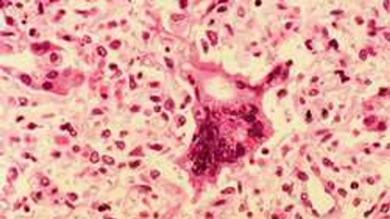 Most közölték: Rohamosan terjed a halálos kór a magyar határ mellett