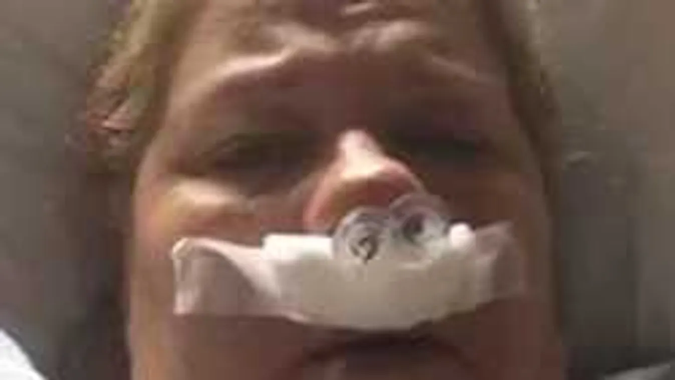 Megműtötték az agydaganattal küzdő magyar sztárt, íme, az eredmény!