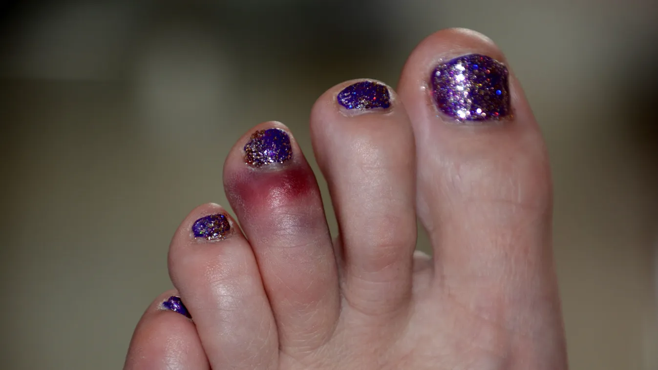 Koronavírus: új tünetek! Ha ezt észleled magadon, hívd a háziorvost!