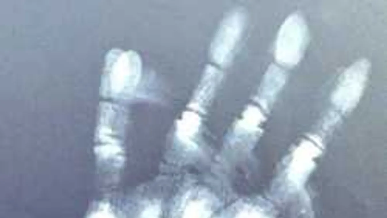 Sokkot kapott az anya, bizarr dolgot fedezett fel kislánya szobájában