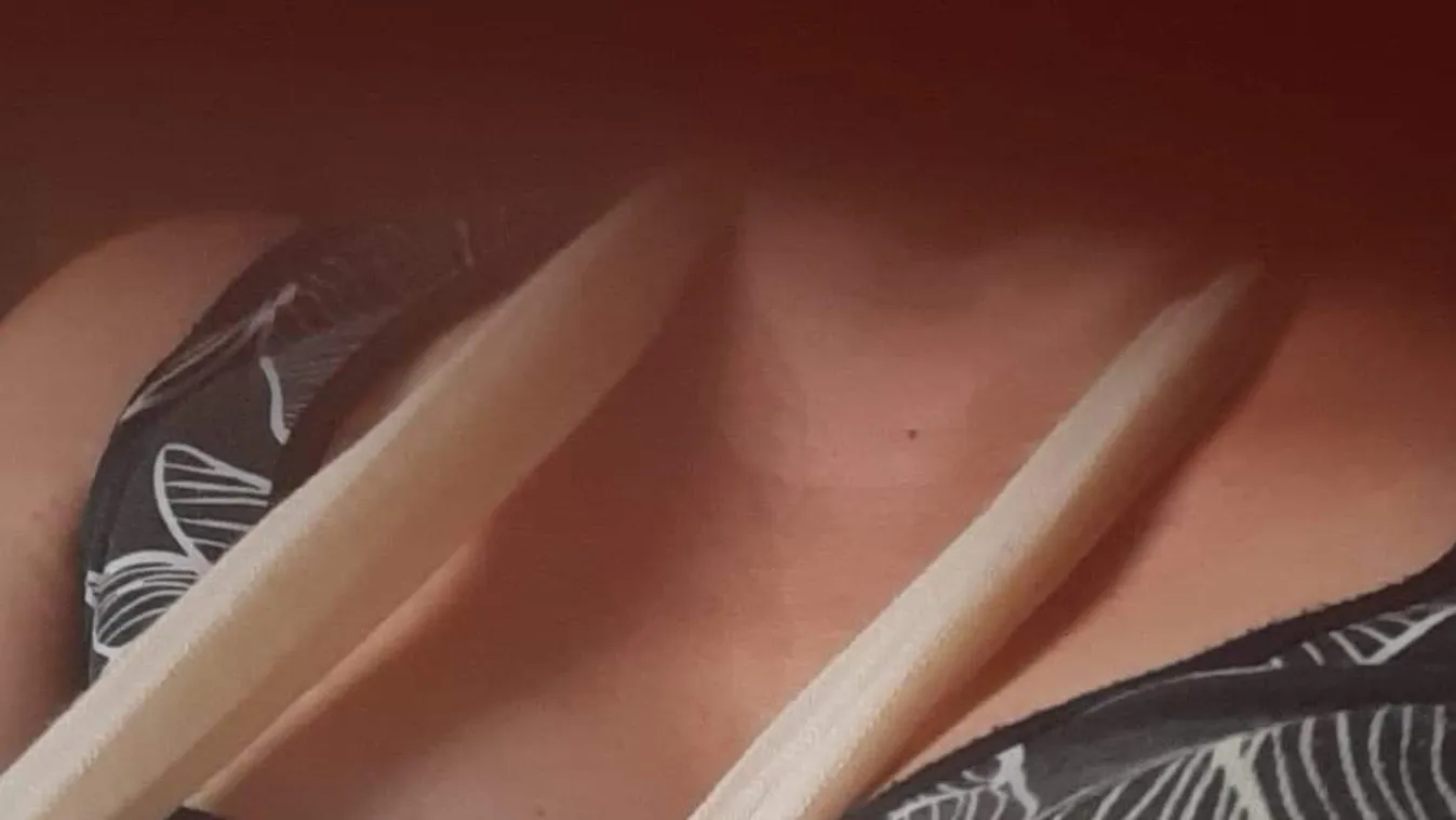 Fiatalok mentették meg az orgonistanő kezét