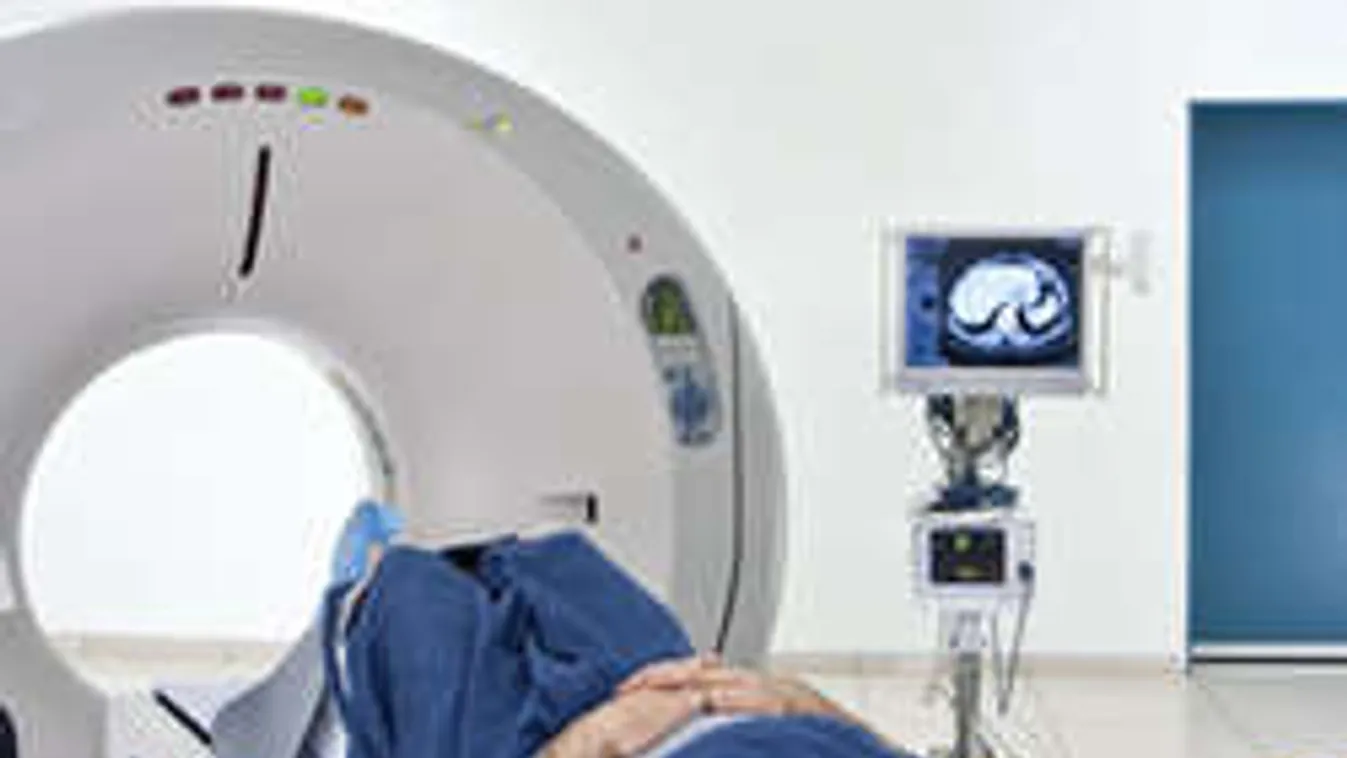 Kiderült, mit mér rosszul az MRI! Kutatók és orvosok vitatkoznak