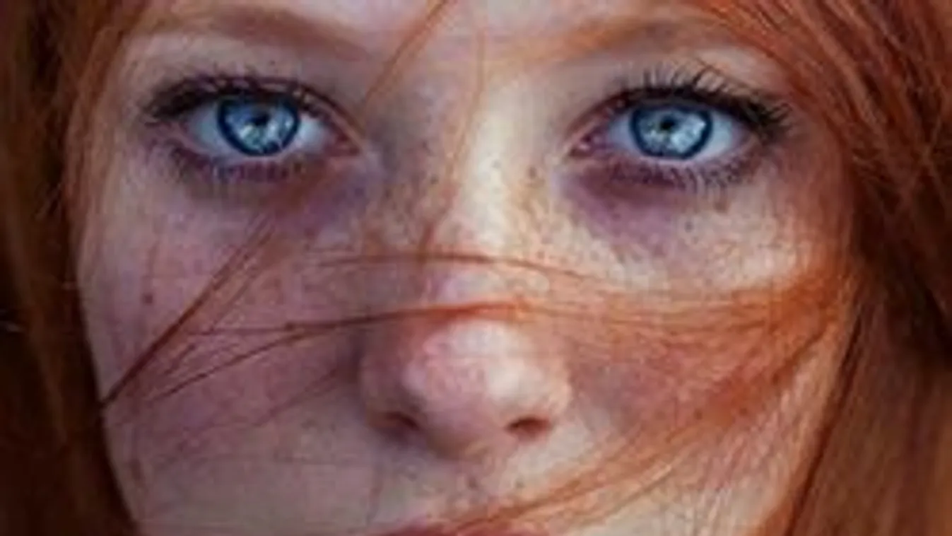 A szemed elárulja, milyen betegségre vagy hajlamos!