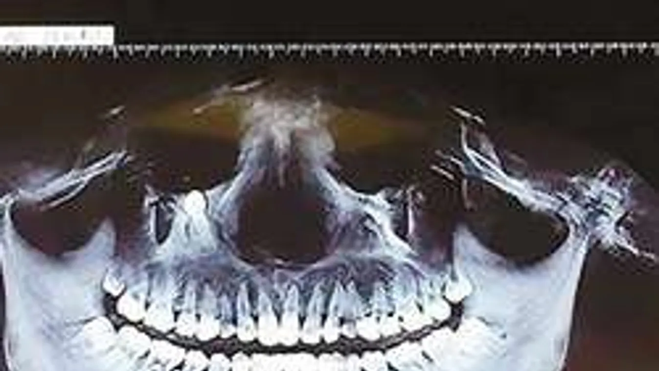 Kész horror! Hihetetlen, hol nőtt ki a foga ennek a nőnek!