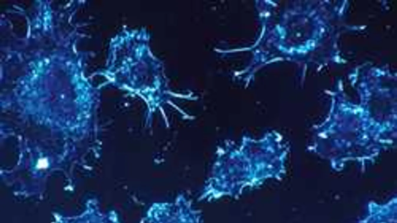 Áttörés: egyetlen vércseppből kimutatják a mellrákot