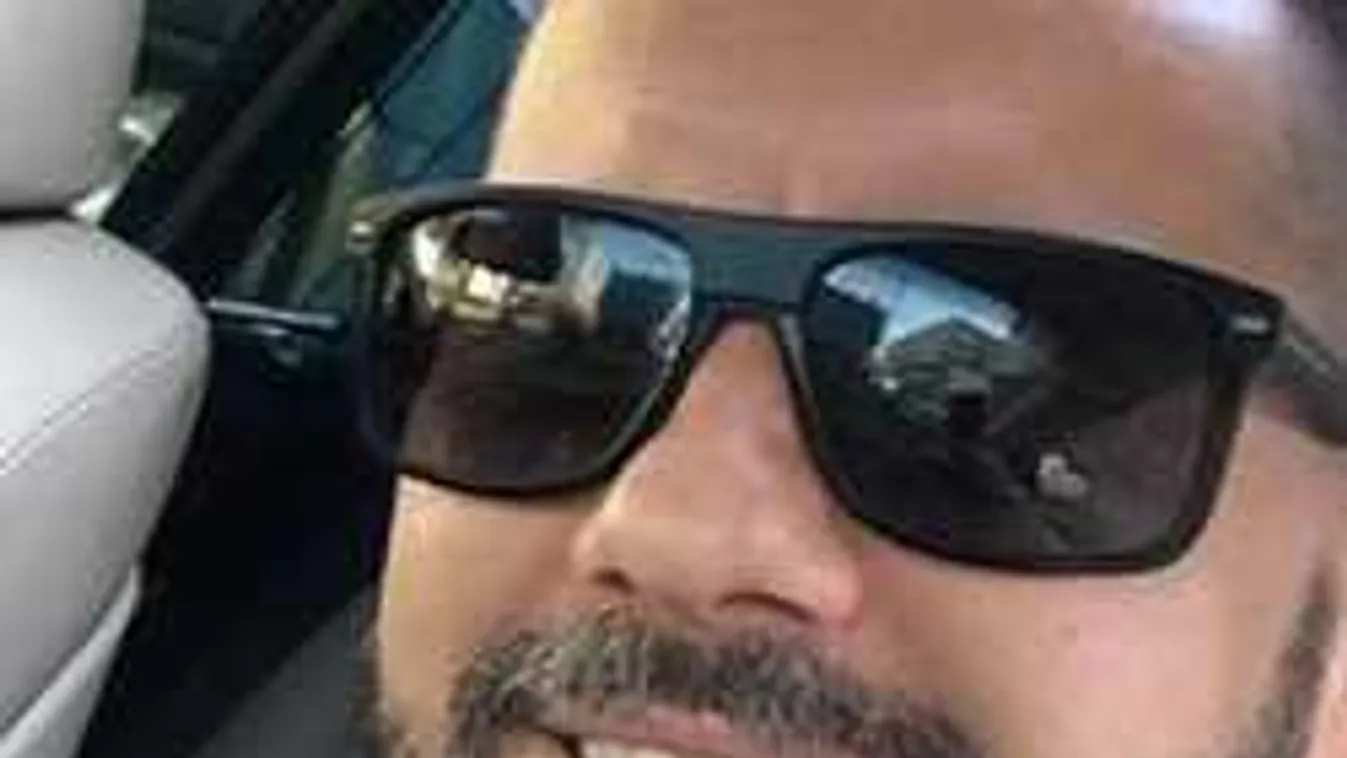 Drámai változás: Felismerhetetlenné vált Kökény Attila arca!