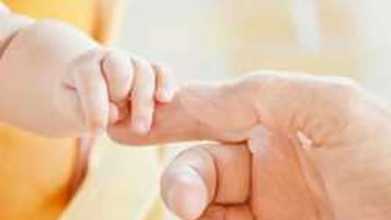 Mindössze 15 percet élt az összenőtt lábakkal született sellőbaba