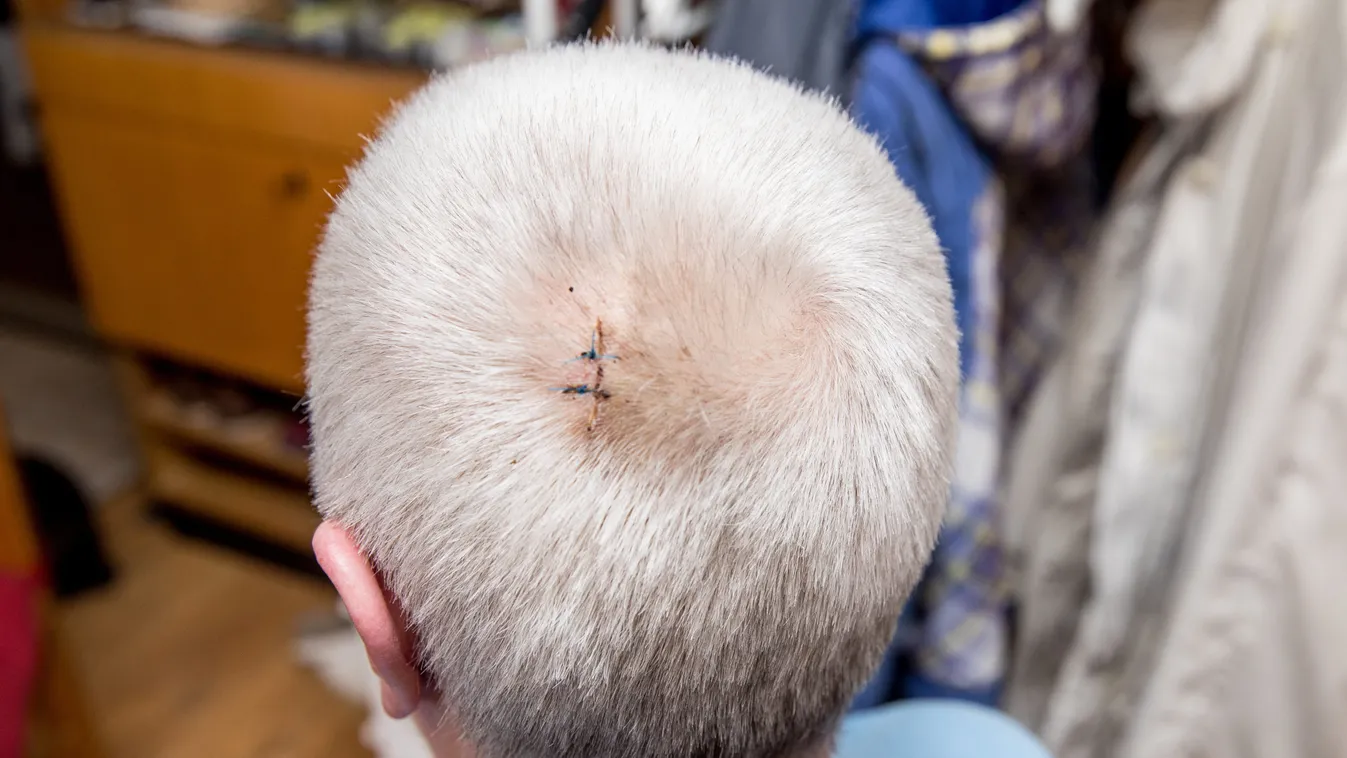 Szörnyű, mit tett a pártfogoltja a budapesti asszonnyal