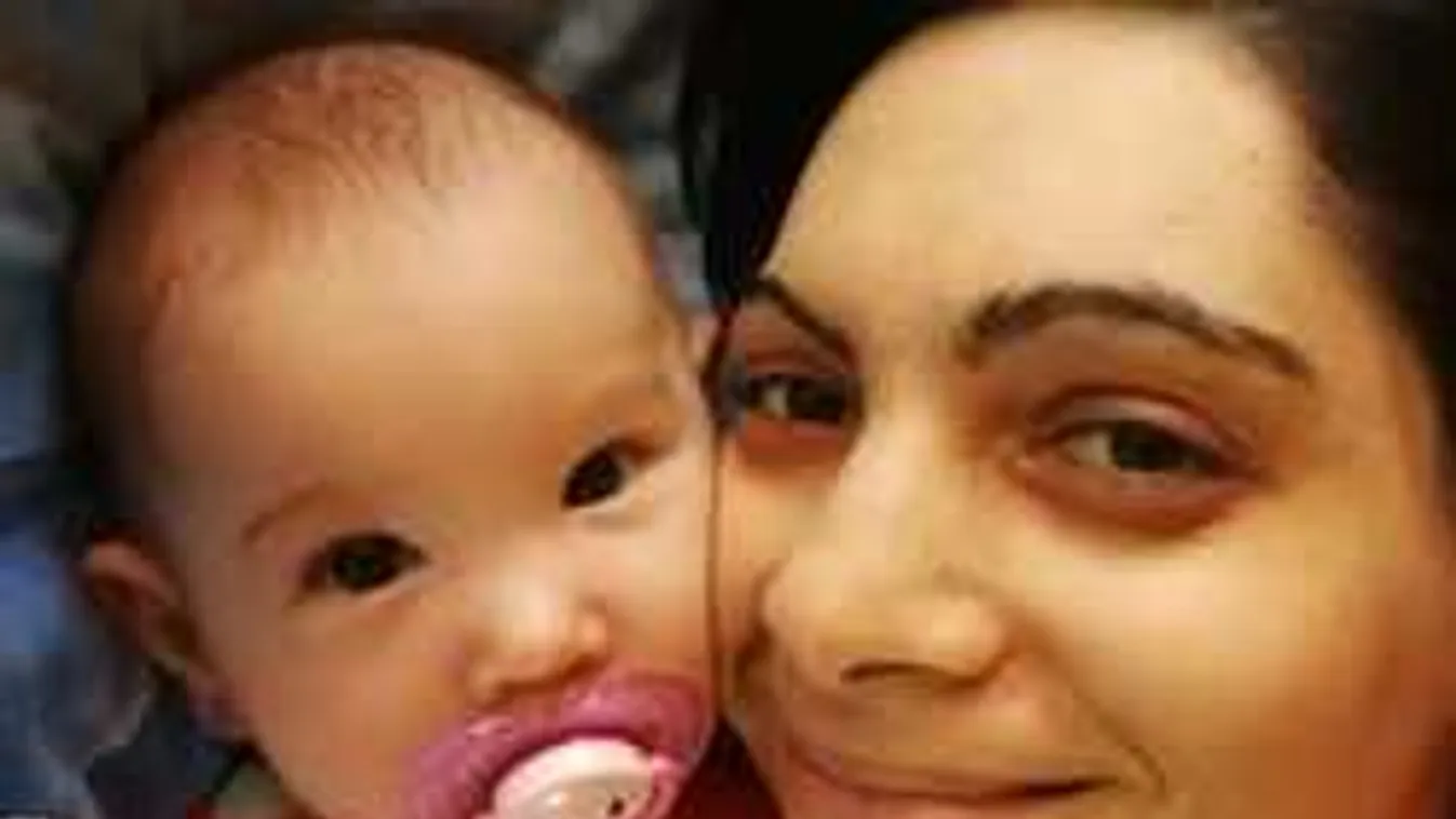 Ölhet ez az egyszerű herpeszvírus: életéért küzd a fiatal édesanya