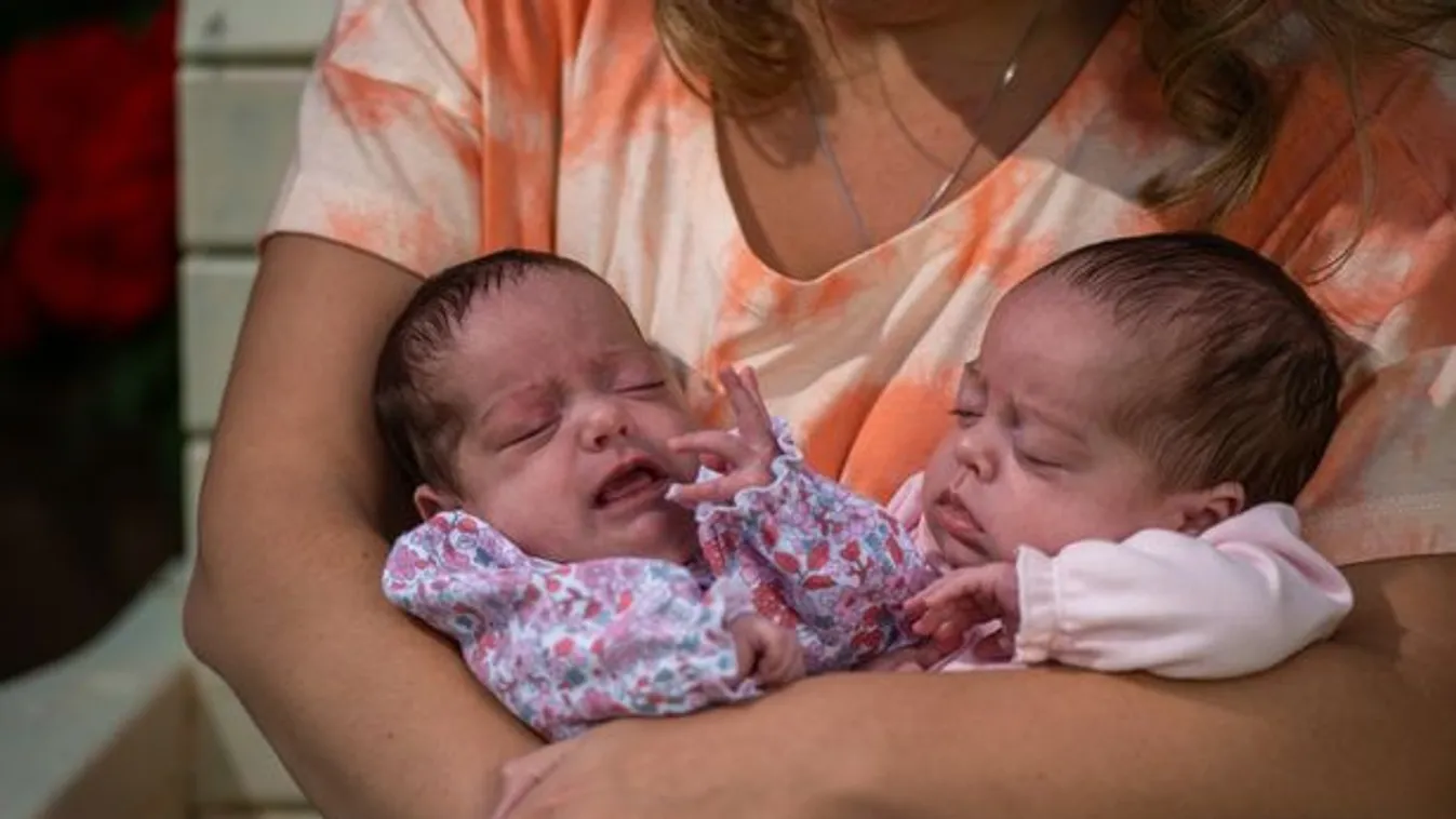 „Igazi csoda, hogy mindketten túlélték„ – megszületett az első ikerpár, akik koronavírussal jöttek világra