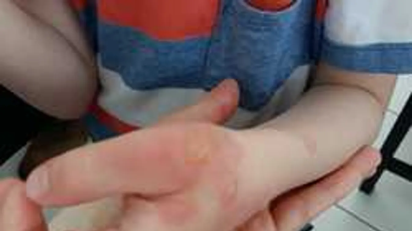 Rettenetes, mit művelt a magyar kisfiúval ez a növény!