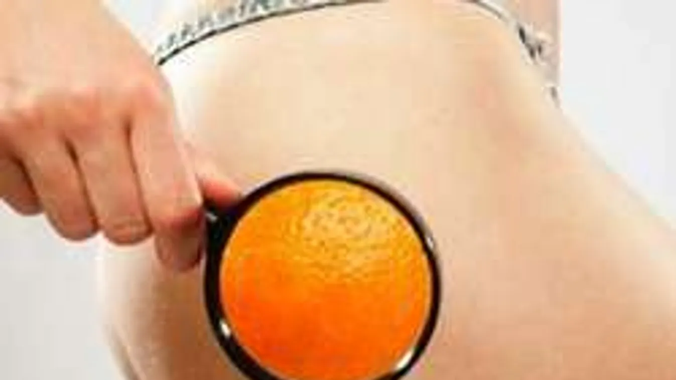 Ez a páros lezabálja rólad a narancsbőrt, 30 fok fölött tökéletes hatás!