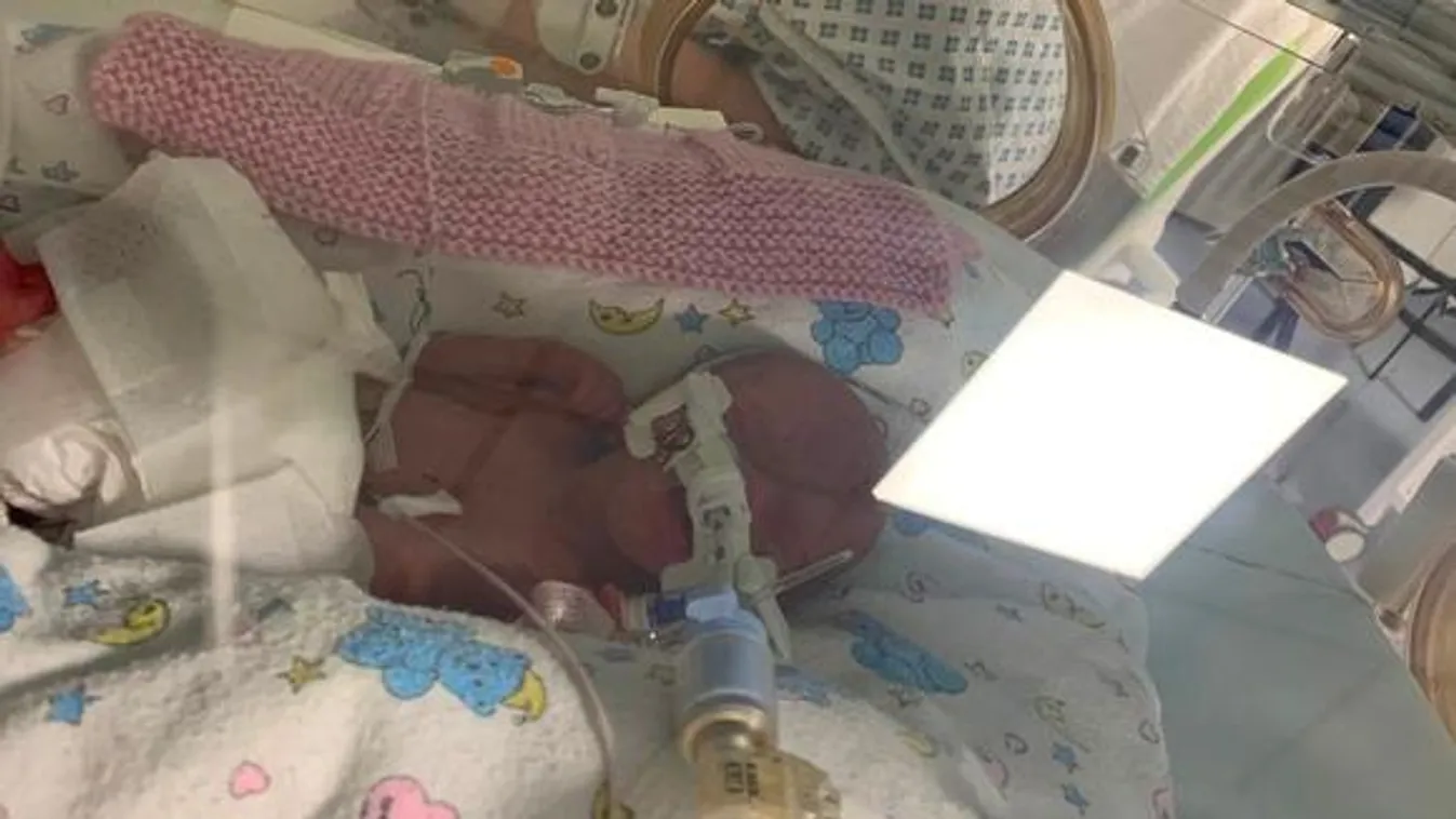 Fél kilót sem nyomott az újszülött