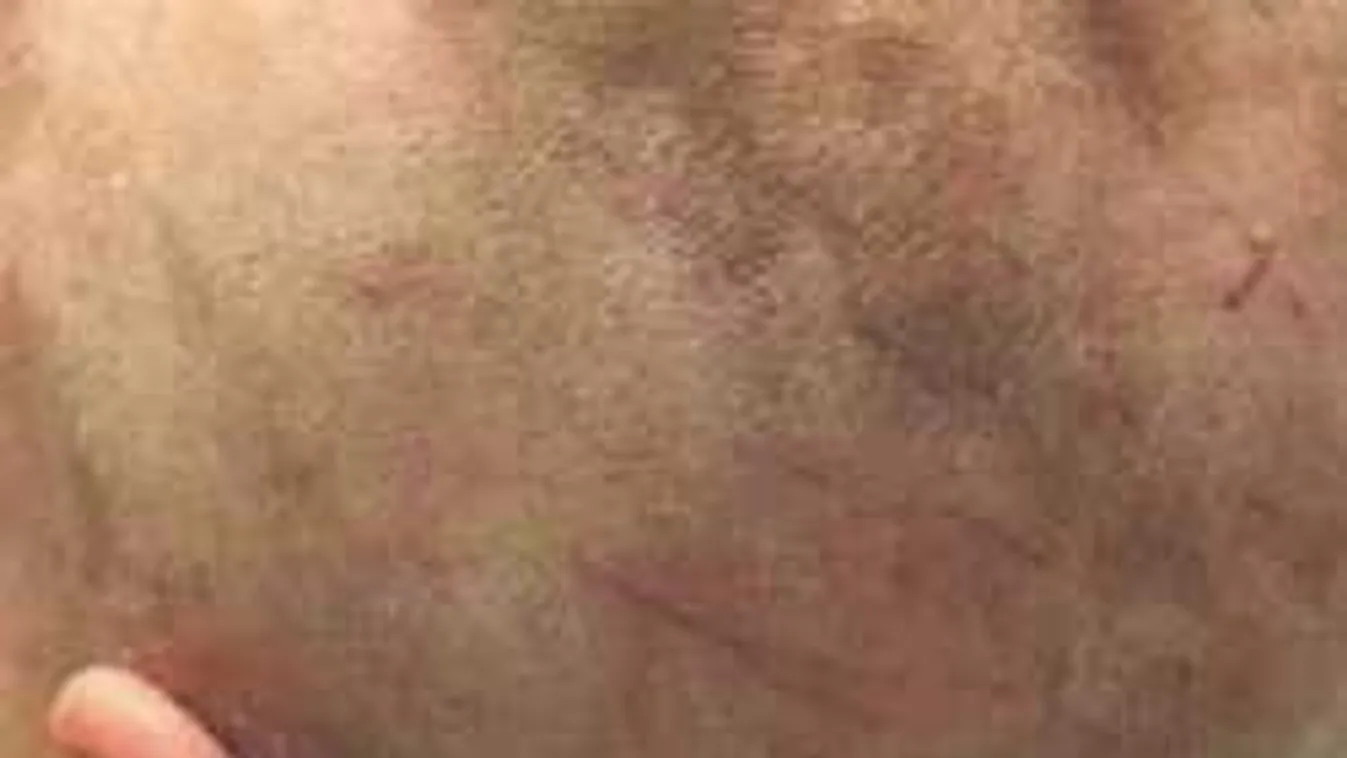 Féltékenységből kopaszra borotválta exe fejét egy őrült férfi