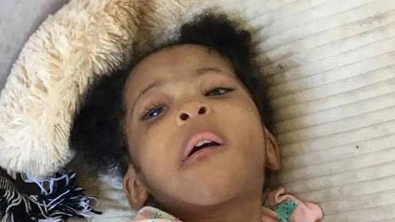 Halálra éheztették 5 éves kislányukat, mindössze három kilót nyomott