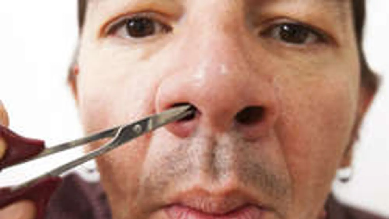 Ne húzd ki az orrszőröd: belehalhatsz!