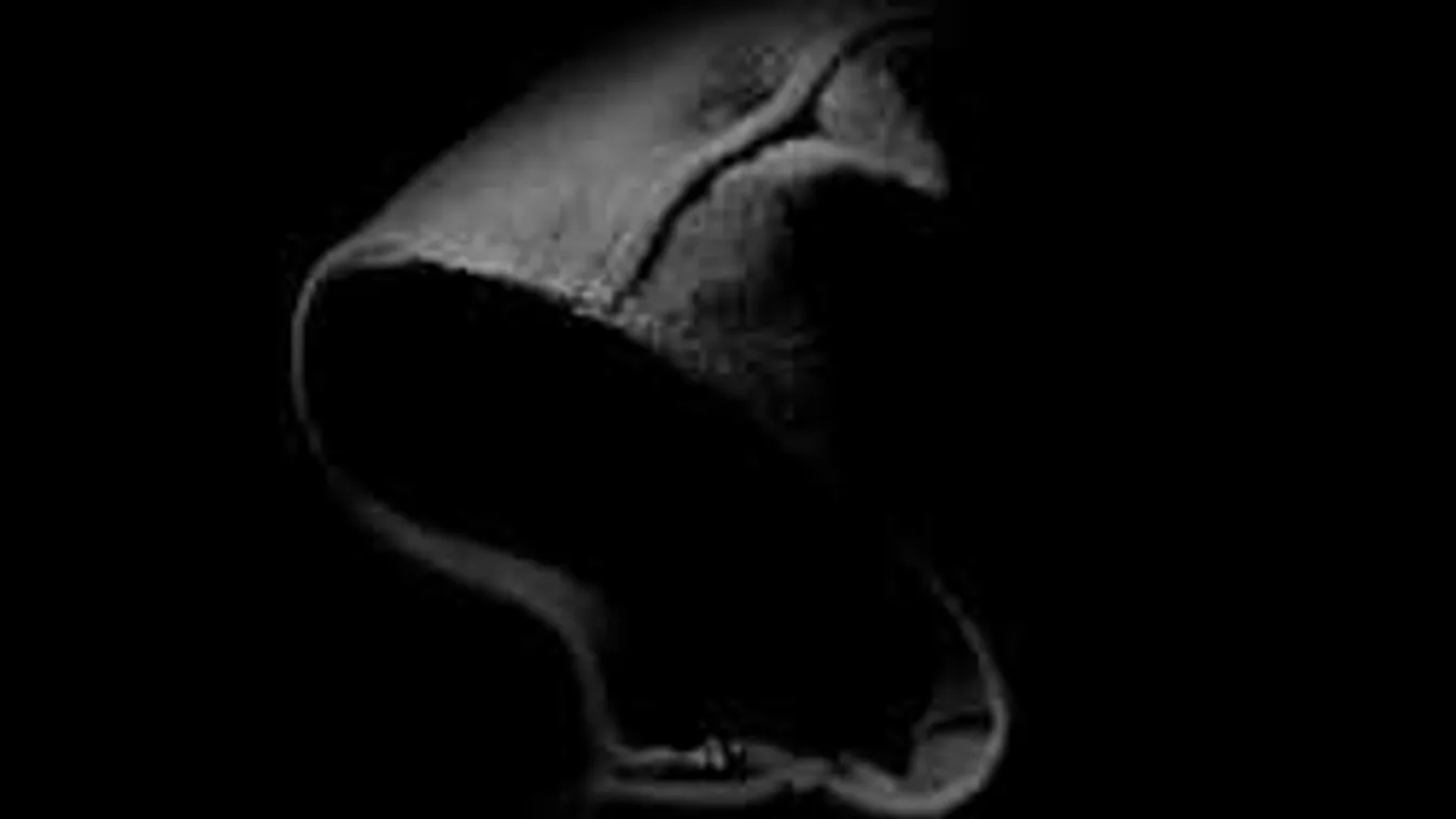 Folytatódik a veresegyházi rettenet, még fiatalabb lányra támadt szatír