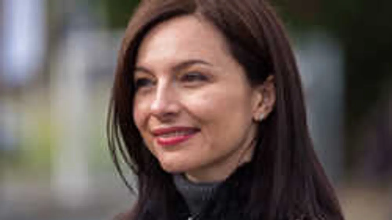 Ezt miért kellett? Szétretusálta az arcát Zséda!