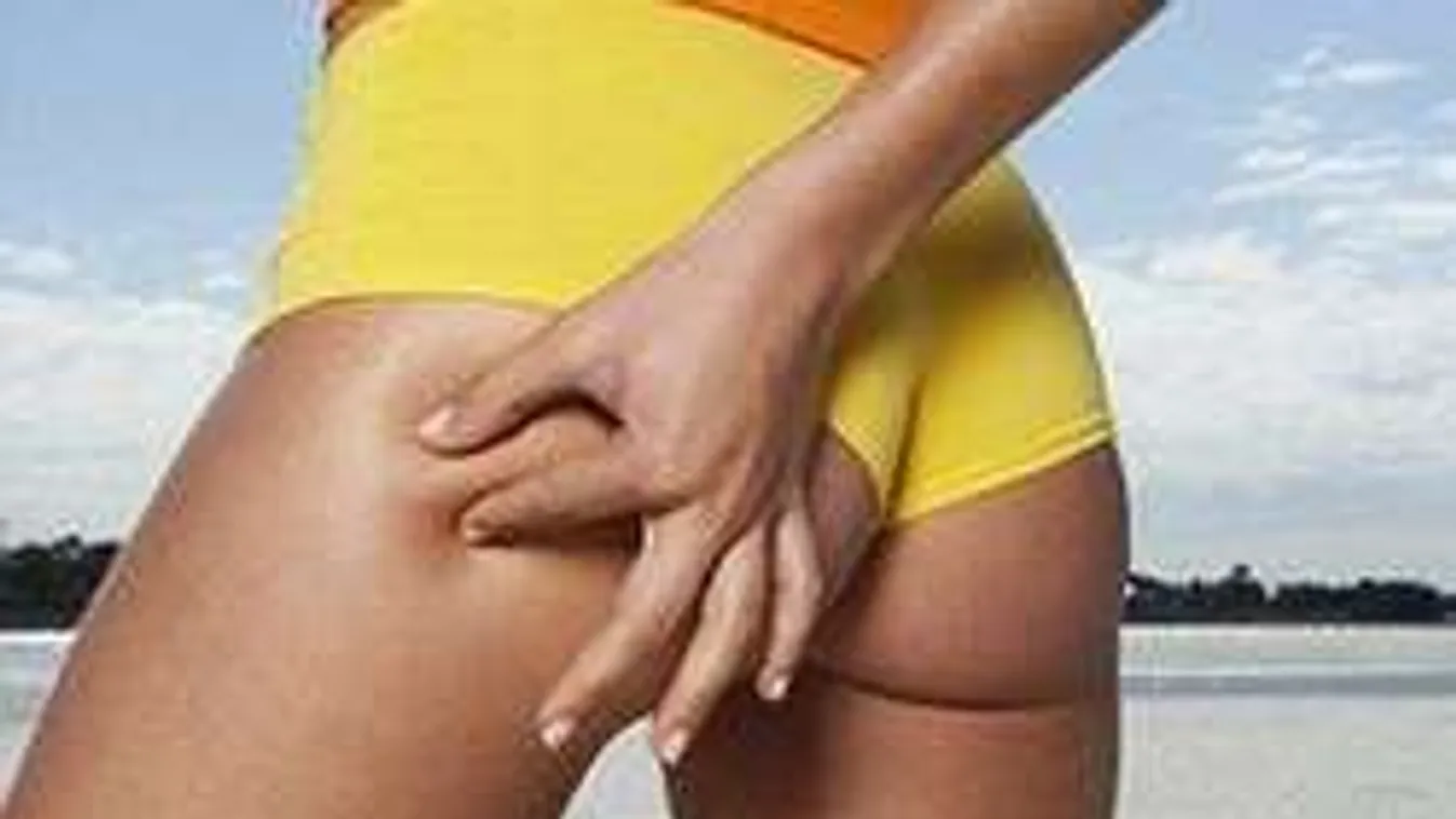 Végre megvan a narancsbőr ellenszere!