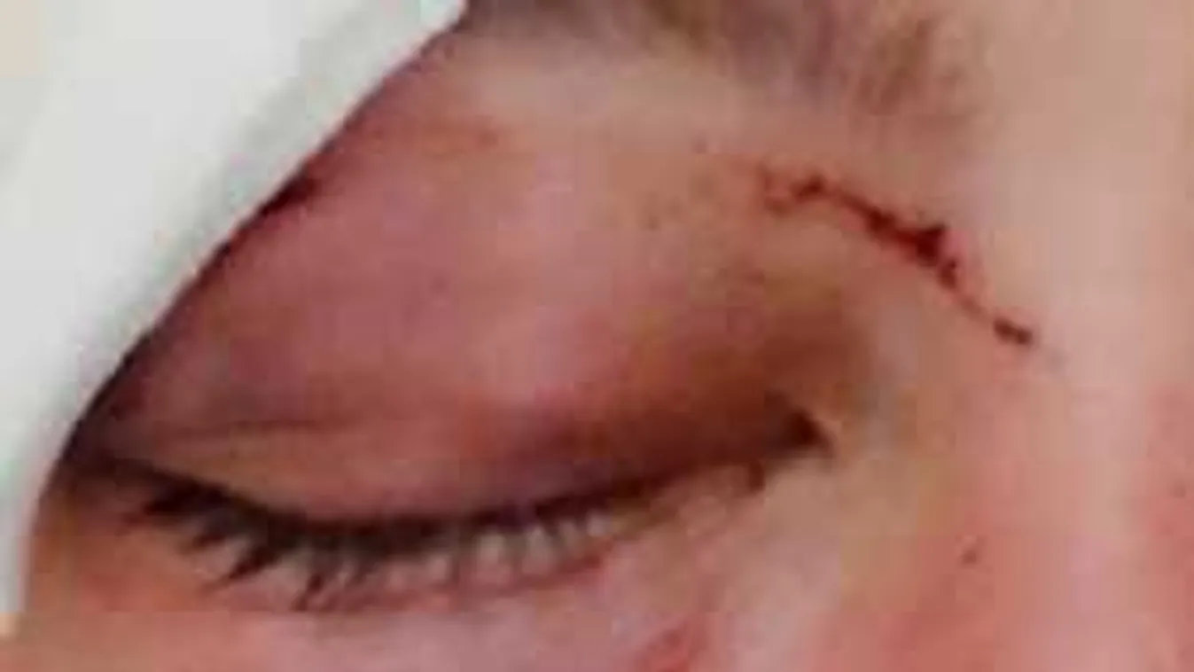 Megtaposták a családos apa arcát Siófokon