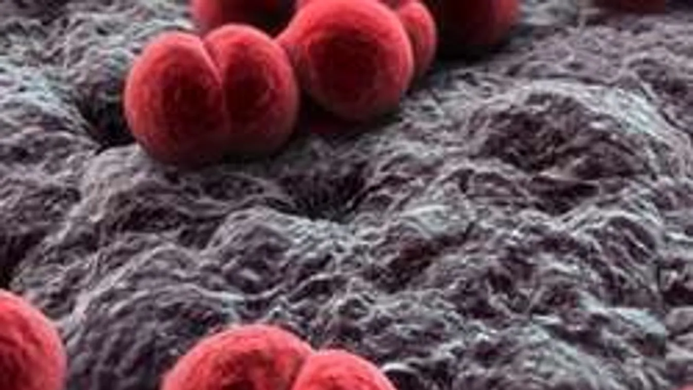 Rémület Budapesten: pár óra alatt végzett az agyhártyagyulladás a gimnazistával