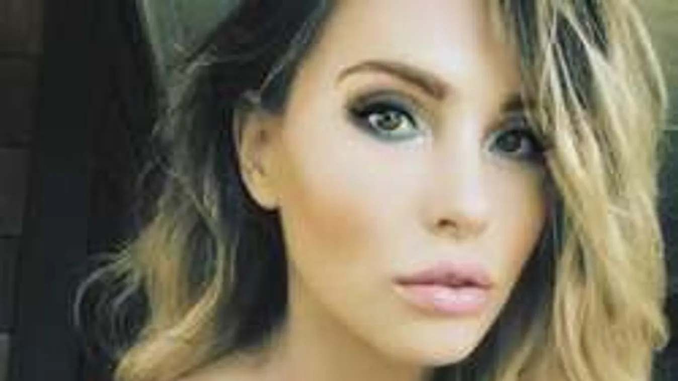 Elképesztő műnővé műtette magát a sztárcsemete